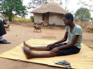 Dokolo woman calls for help, after battling a strange illness for over 20 years